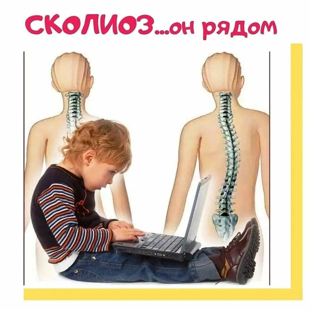 профилактика сколиоза