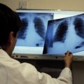 Пресс – релиз проведения месячника по профилактике туберкулеза с  24 февраля – 23 марта         и приуроченного к нему Всемирного дня борьбы с туберкулезом (24 марта)