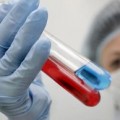 №3 ПҚА АИТВ бойынша дәрігерлік конференция өтті